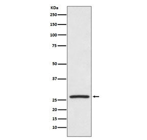 HSP27 Antibody / HSPB1