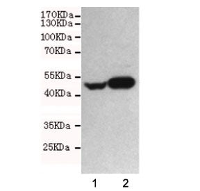 NSE Antibody / Neuron Specific Enolase