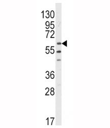 LYN Antibody