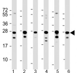 PIMT Antibody / PCMT1