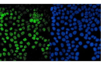 PTF1A Antibody
