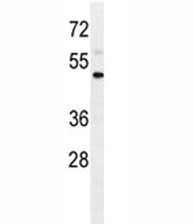 IL1R2 Antibody