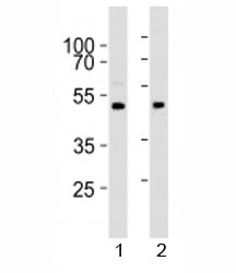 Western blot analysis of lysate from 1) human brain and 2) mouse brain tissue lysate using PRMT8 ant