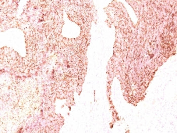 Chromogranin A Antibody