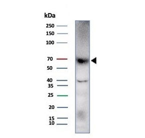 Western blot testing of human HDLM-2 cell lysate with Perforin-1 antibody (clone rPRF1/8058). Predic