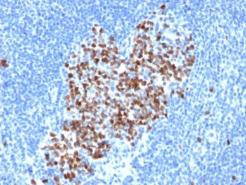Topoisomerase II alpha Antibody / TOP2A