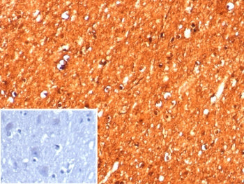 IHC staining of FFPE human brain tissue with Creatine kinase B antibody (clone CKBB/8608R). Inset: P
