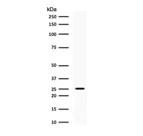 Western blot testing of human PC3 cell lysate with C1QA antibody (clone CCSA-1). Predicted molecular