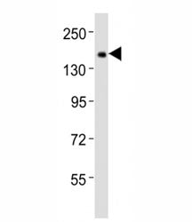 Western blot testing of Tet1 antibody at 1:2000 dilution + mouse F9 lysate; Predicted molecular weig