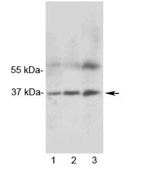 Western blot testing of 1) rat heart, 2) rat skeletal muscle and 3) human MCF7 lysate with MRGX1 ant