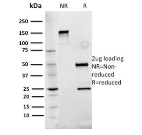 FN1 Antibody / Fibronectin