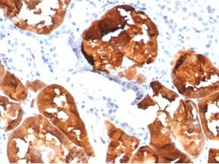 FABP1 Antibody