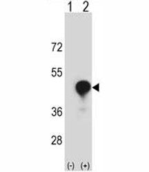 CD1c Antibody