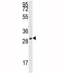 TPSAB1 Antibody