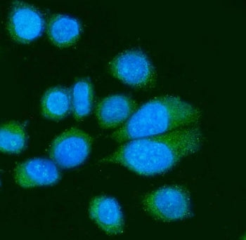 Poliovirus Receptor Antibody / PVR