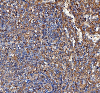 Kindlin-2 Antibody / KIND2 / FERMT2