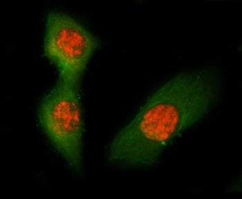 Tms1 Antibody / Pycard / mASC