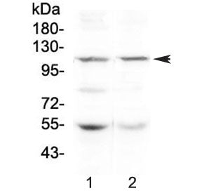 Western blot testing of human 1) HeLa and 2) SW620 lysate with DPYD antibody at 0.5ug/ml. Predicted 