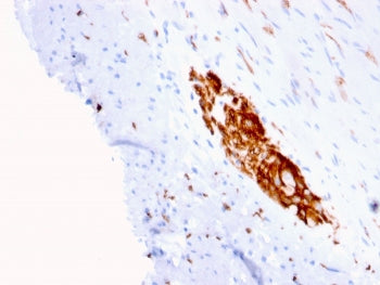 IHC staining of FFPE human colon with NCAM antibody (clone ERIC-1). HIER: boil tissue sections in pH