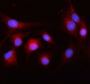 OSBPL10 Antibody