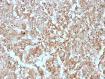 DOG1 Antibody / TMEM16A / ANO1