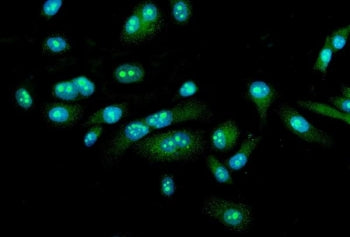 FEZF1 Antibody