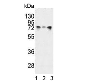 HSPA5 Antibody / GRP78 / BiP