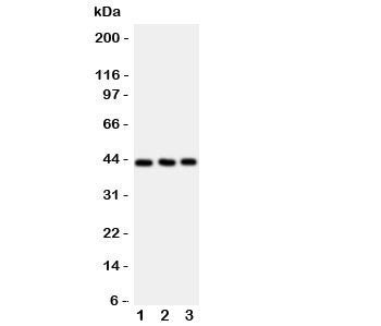 Western blot testing of CCR9 antibody and Lane 1: Jurkat; 2: HeLa; 3: SMMC-7721 cell lysate. Expecte