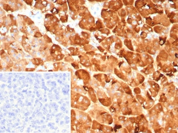 PNLIP Antibody / Pancreatic lipase