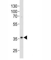 Anit-GAPDH Antibody