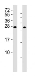 Western blot testing of RHOXF1 antibody at 1:2000; Lane 1: A2058 cell lysate, Lane 2: human ovary ly