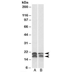 NME1 Antibody
