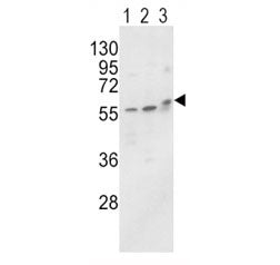 Alkaline Phosphatase Antibody