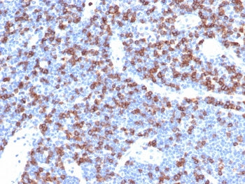 IHC staining of FFPE human lymph node tissue with recombinant CD8A antibody (clone CD8/4391R). HIER:
