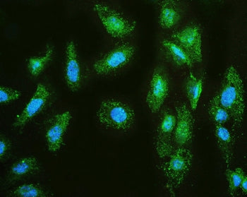 MMP1 Antibody