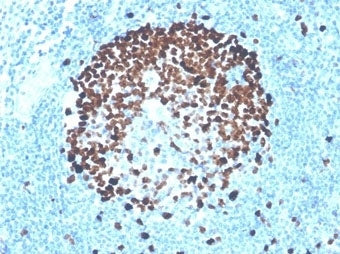 IHC staining of FFPE human tonsil tissue with recombinant Ki67 antibody (clone MKI67/4947R). HIER: b