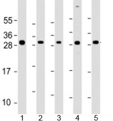 Western blot testing of human 1) SK-BR-3, 2) HeLa, 3) HCT116, 4) MCF-7 and 5) HL-60 cell lysate with