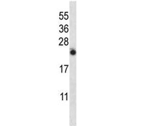 IL-13 antibody western blot analysis in NCI-H460 lysate. Expected molecular weight: 16-35 kDa depend