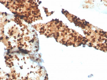 IHC staining of FFPE human spleen with recombinant S100P antibody. HIER: boil tissue sections in pH 