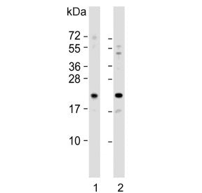 GLO1 Antibody / Glyoxalase I