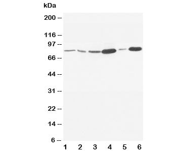 Western blot testing of MMP9 antibody and Lane 1: rat embryo; 2: MM453; 3: HeLa; 4: SMMC-7721; 5: Ju
