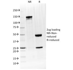 IL-4 Antibody