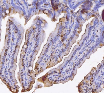 IHC staining of FFPE mouse colon tissue with Bid antibody. HIER: boil tissue sections in pH8 EDTA fo