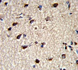 Dermatopontin Antibody / DPT