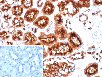 IHC staining of FFPE human colon tissue with recombinant CD10 antibody (clone MME/9617R). Inset: PBS