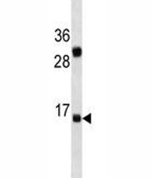 IL-2 Antibody