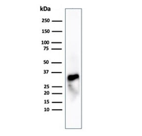 Western blot testing of human spleen tissue lysate using recombinant Granzyme B antibody (clone GZMB