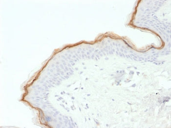 Filaggrin Antibody