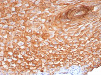 IHC staining of FFPE human skin tissue with Suprabasin antibody (clone SBSN/7965). HIER: boil tissue