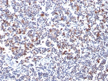 IHC staining of FFPE human tonsil with OX40 antibody. HIER: boil tissue sections in pH 9 10mM Tris w